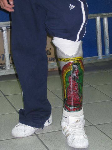 Protesis parcial de pie
