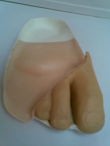 Ortoprotesis